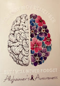 Alzheimer’s