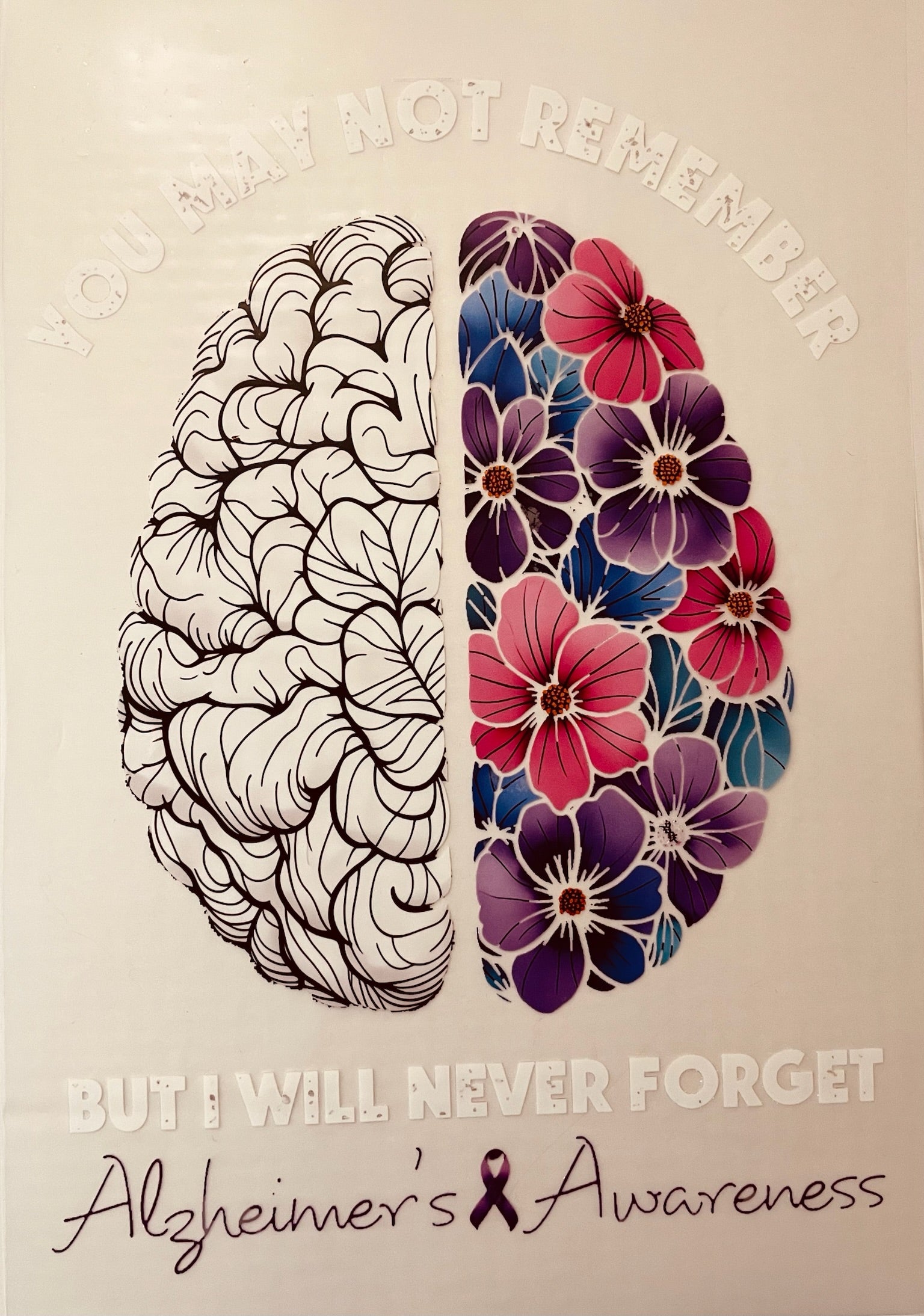 Alzheimer’s